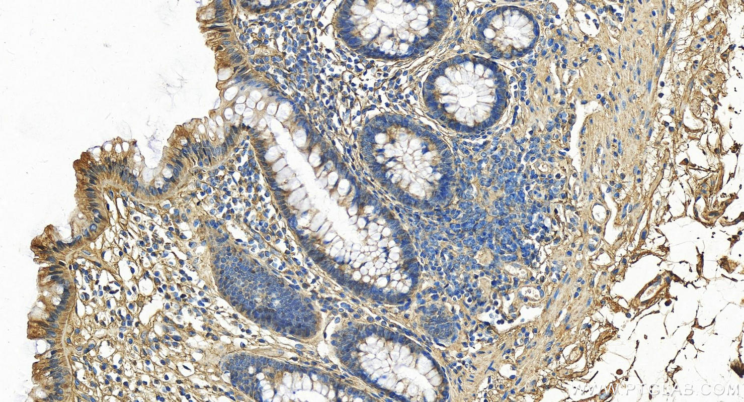 IHC staining of human normal colon using 16409-1-AP