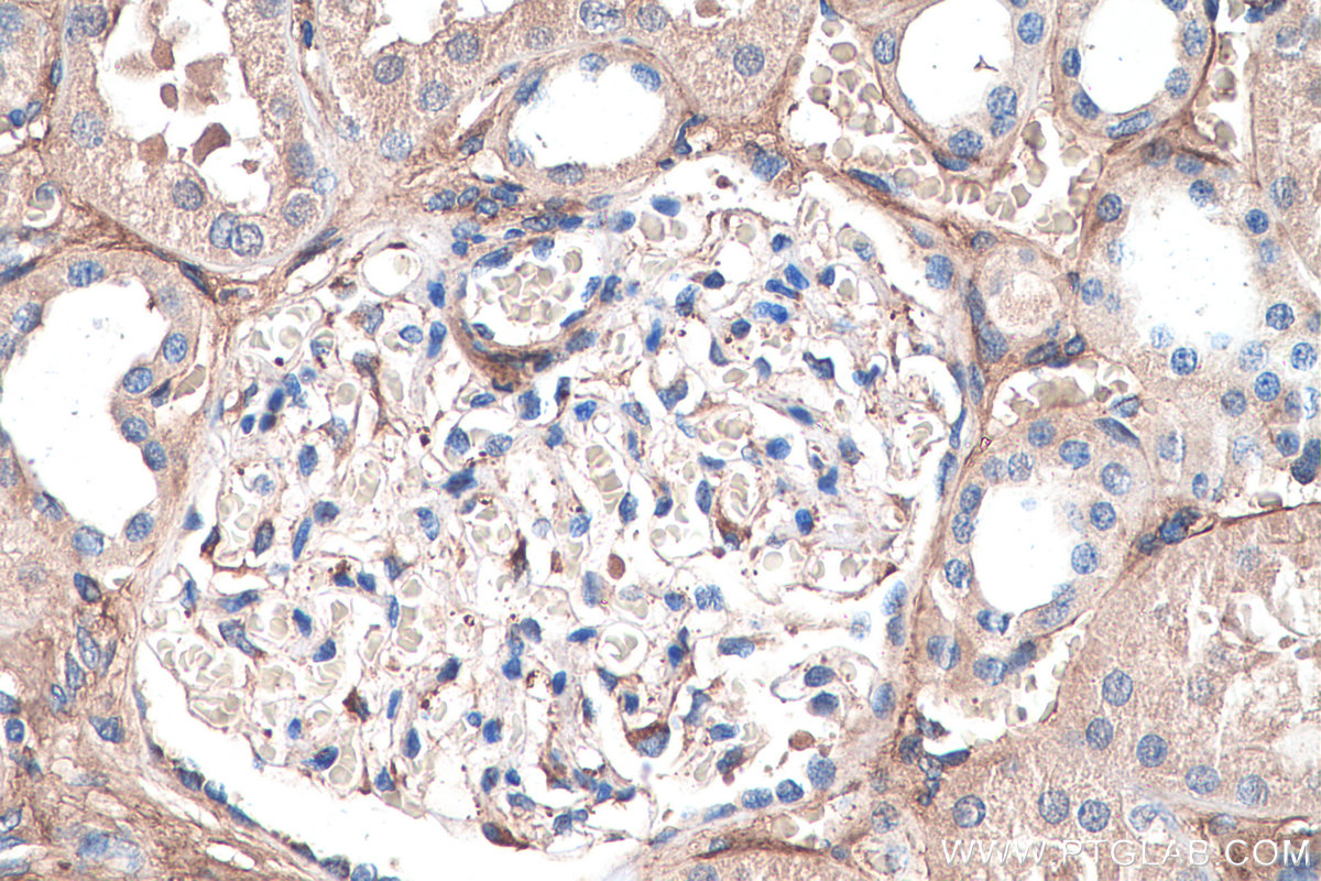 IHC staining of human kidney using 16409-1-AP