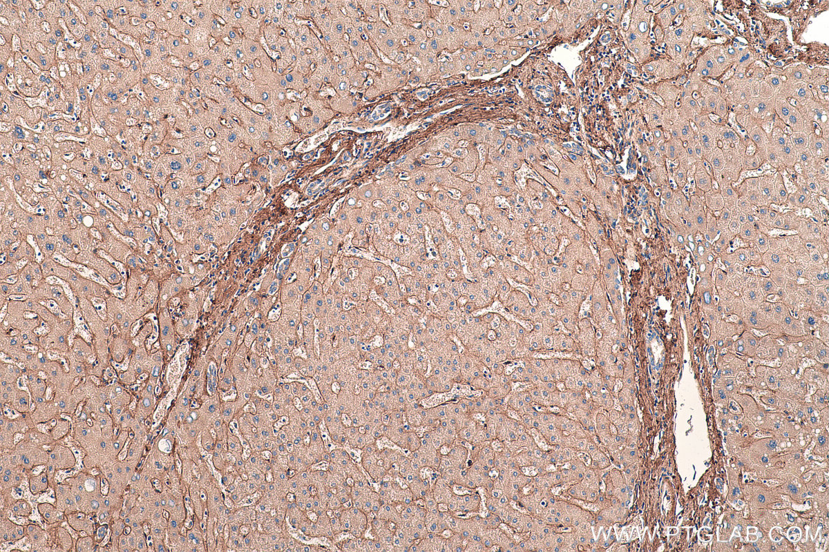IHC staining of human liver using 16409-1-AP
