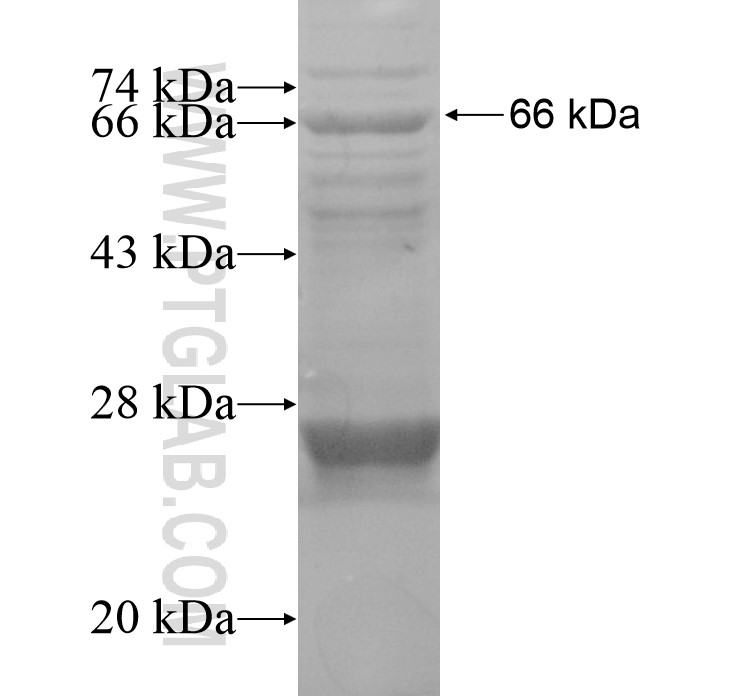 BHLHB9 fusion protein Ag15269 SDS-PAGE BHLHB9 fusion protein Ag15269 SDS-PAGE