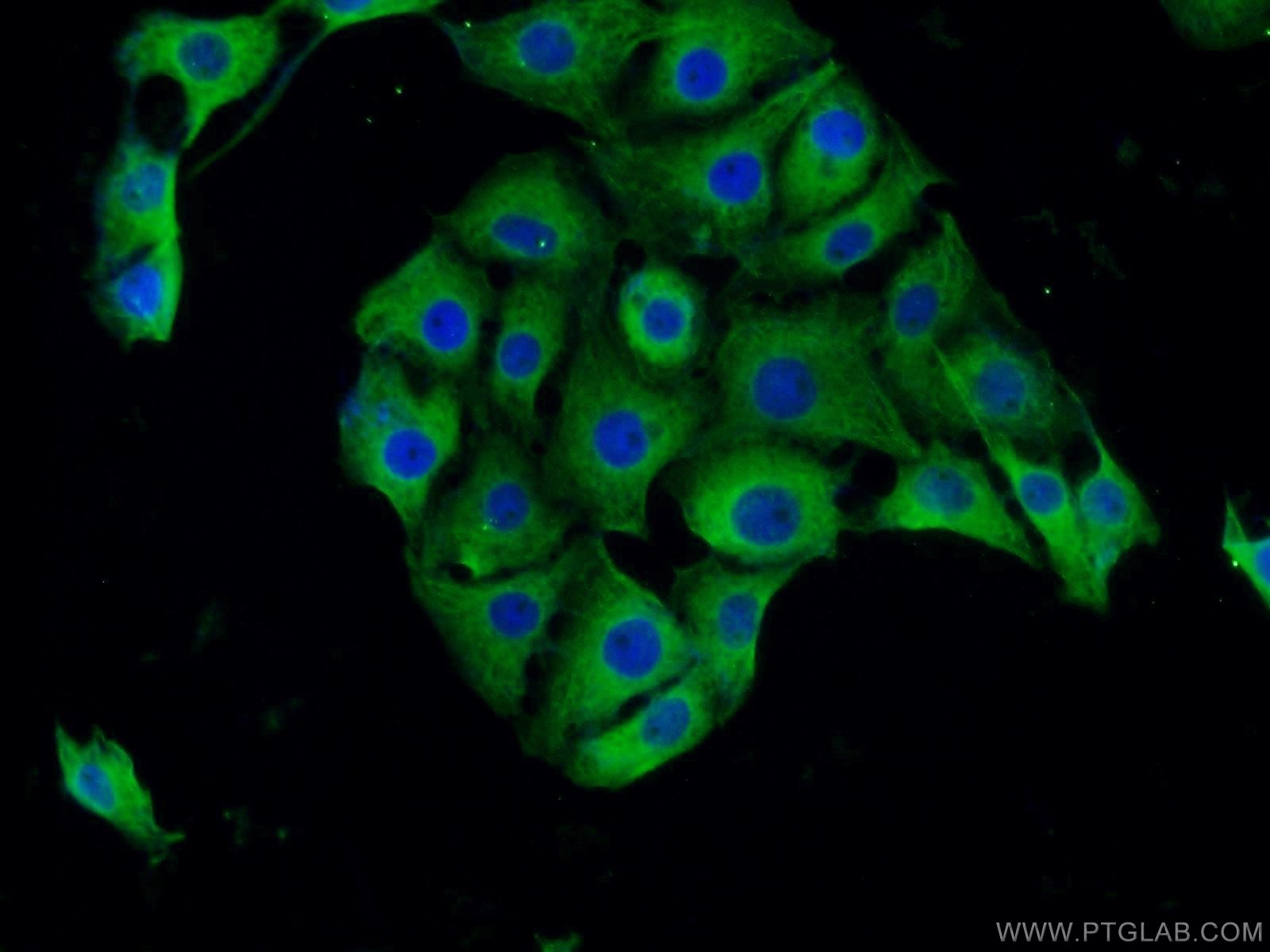 IF Staining of SH-SY5Y using 25622-1-AP