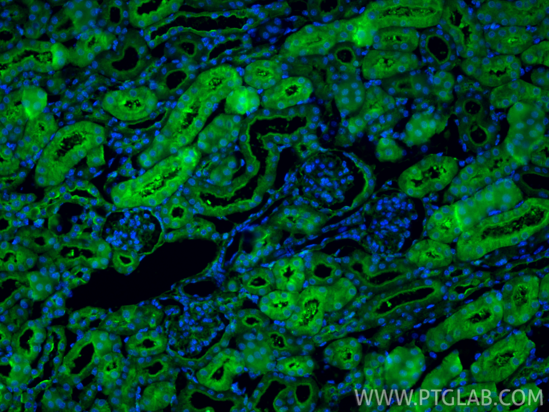 IF Staining of mouse kidney using 15965-1-AP