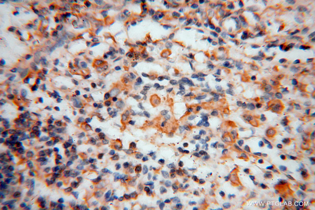 IHC staining of human spleen using 15965-1-AP