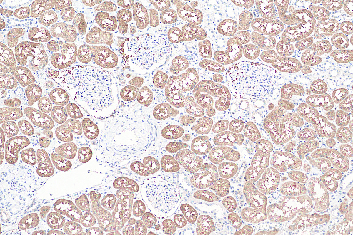 IHC staining of human kidney using 16351-1-AP