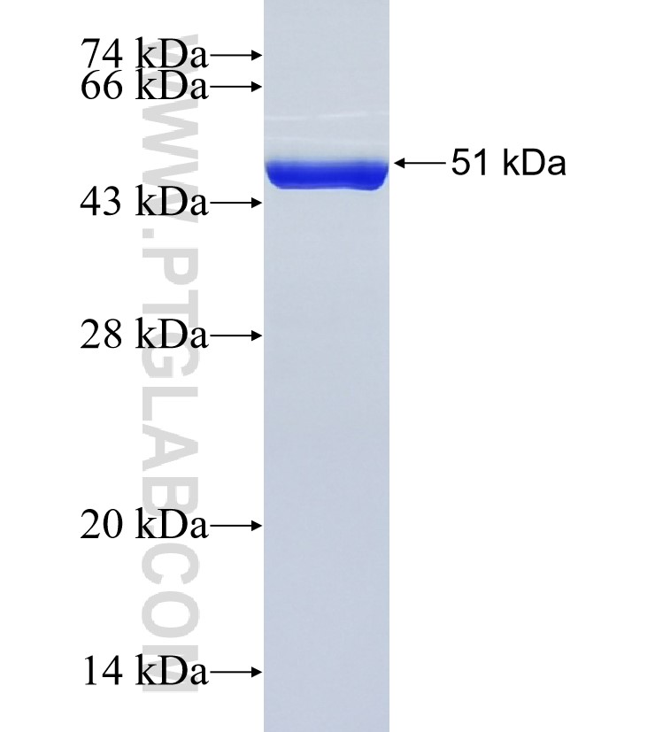 BICD1 fusion protein Ag17534 SDS-PAGE BICD1 fusion protein Ag17534 SDS-PAGE