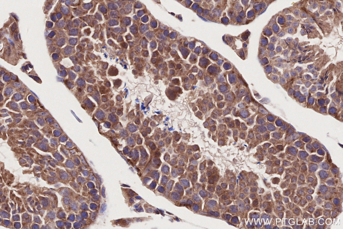 IHC staining of mouse testis using 29603-1-AP IHC staining of mouse testis using 29603-1-AP