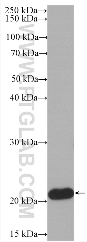 WB analysis of Jurkat using HRP-60301