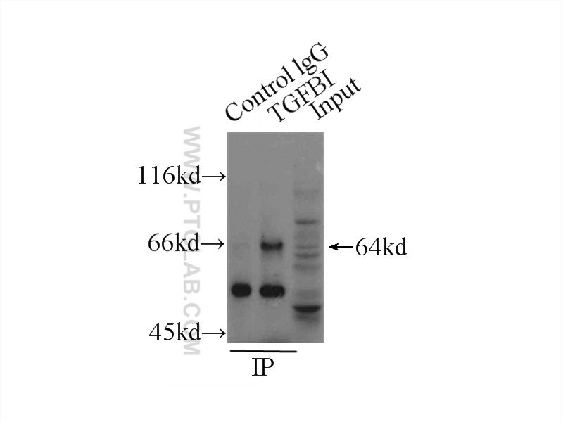 IP experiment of HeLa using 10188-1-AP