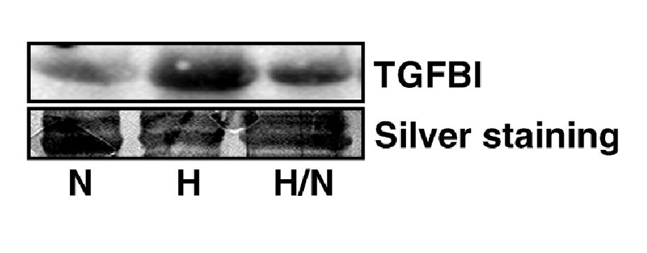 TGFBI / BIGH3