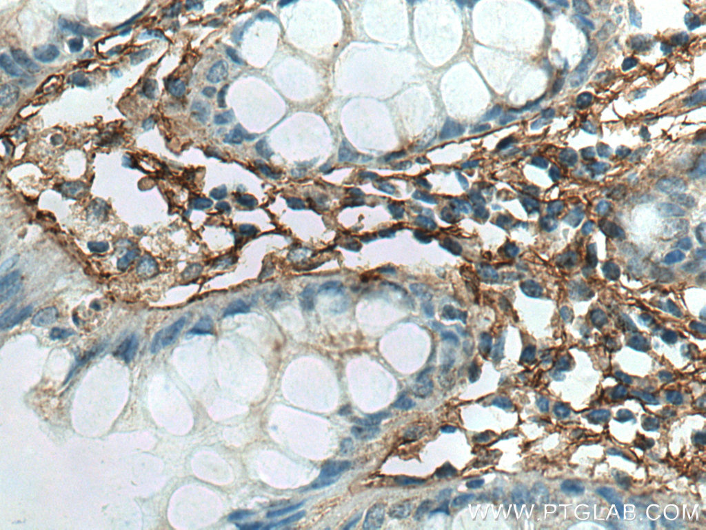 IHC staining of human colon using 60007-1-Ig