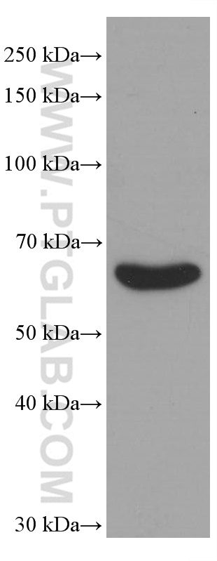 WB analysis of human kidney using 60007-1-Ig