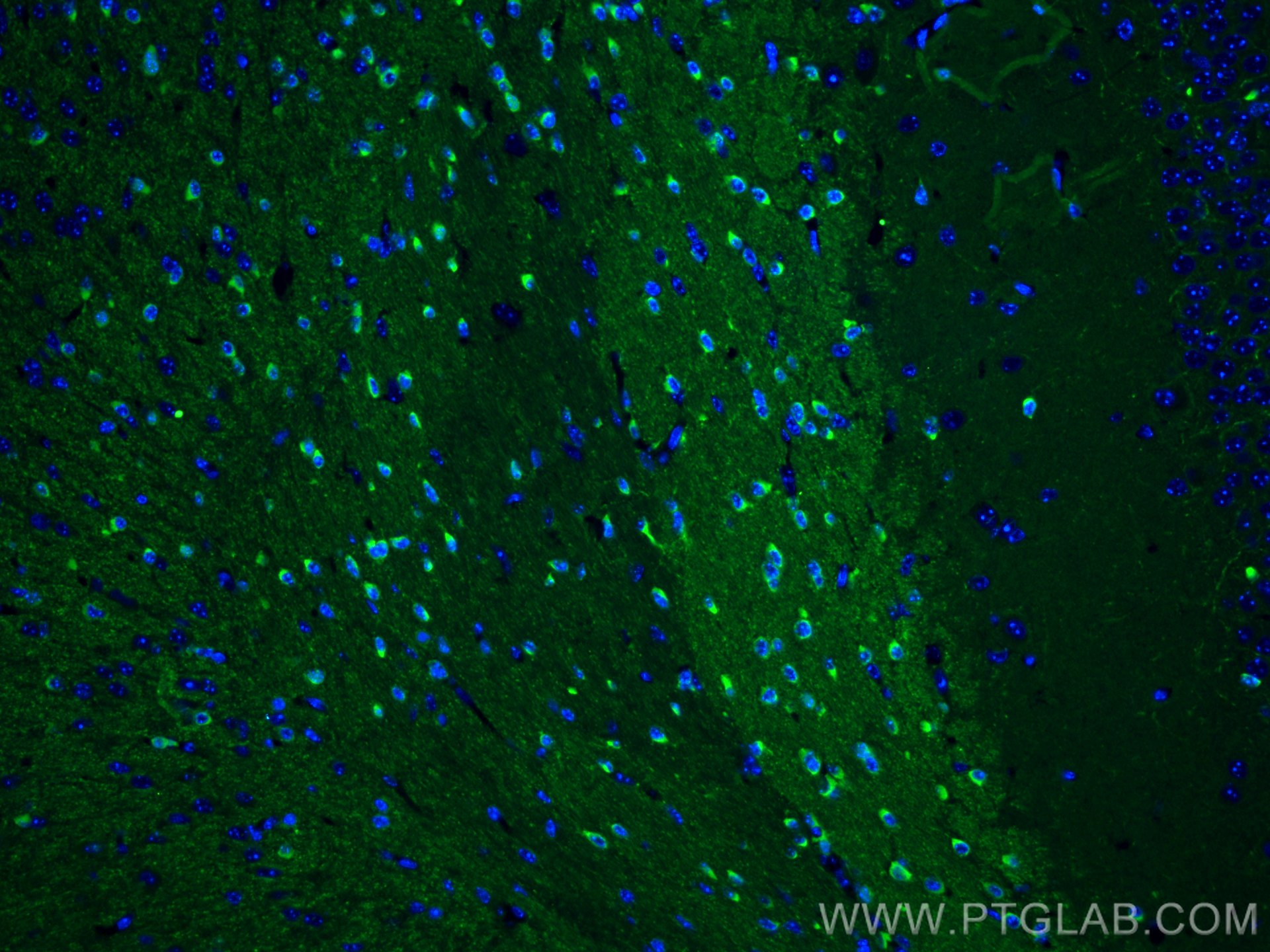 IF Staining of mouse brain using 14647-1-AP (same clone as 14647-1-PBS)
