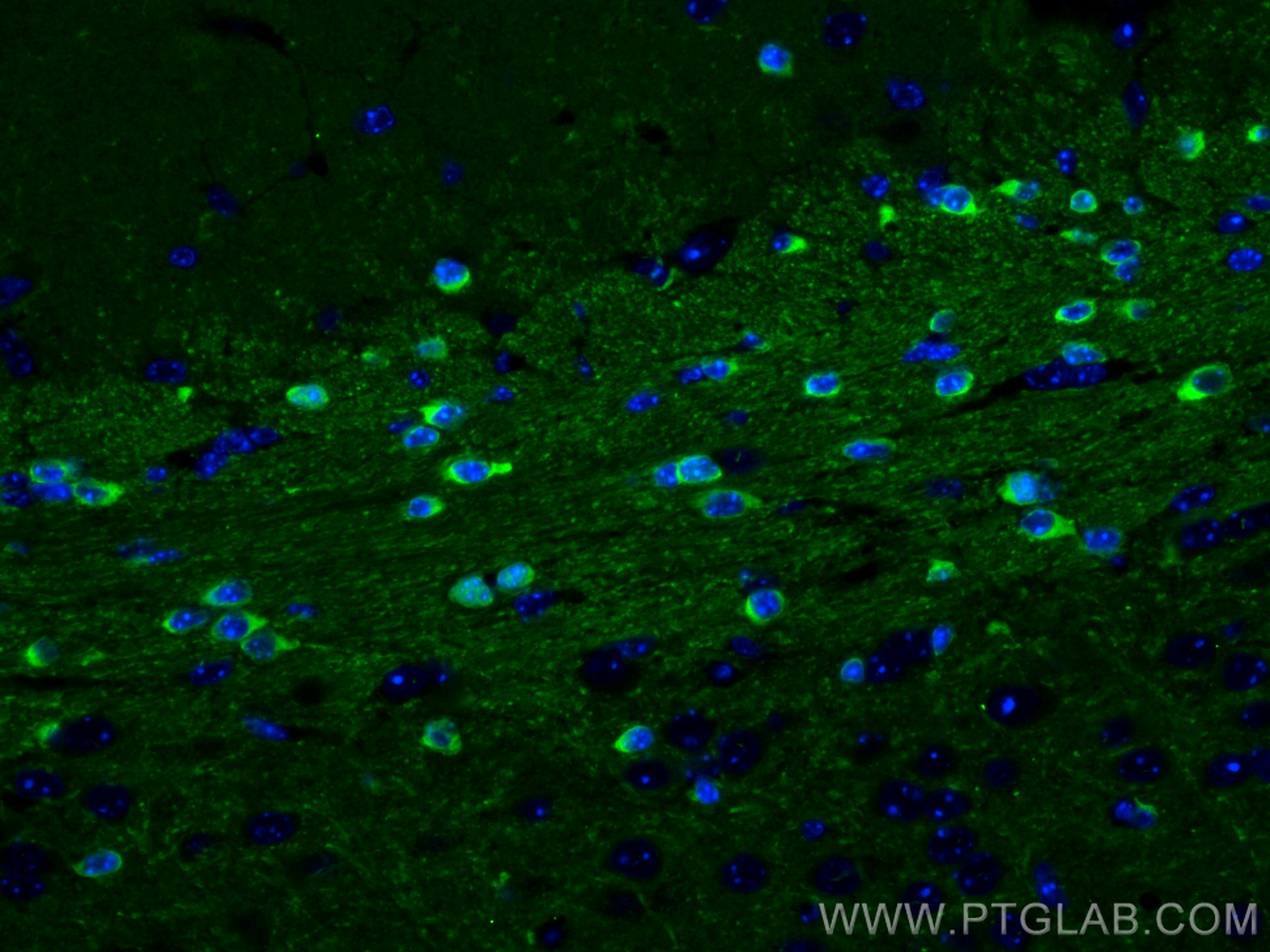 IF Staining of mouse brain using 14647-1-AP