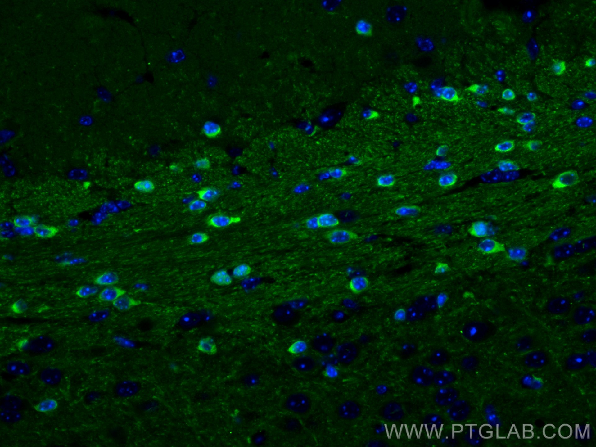 IF Staining of mouse brain using 14647-1-AP (same clone as 14647-1-PBS)
