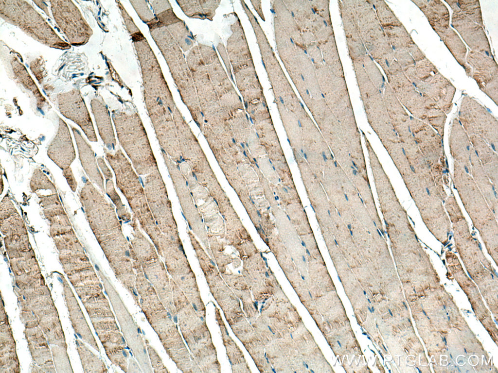 IHC staining of mouse skeletal muscle using 14647-1-AP (same clone as 14647-1-PBS)