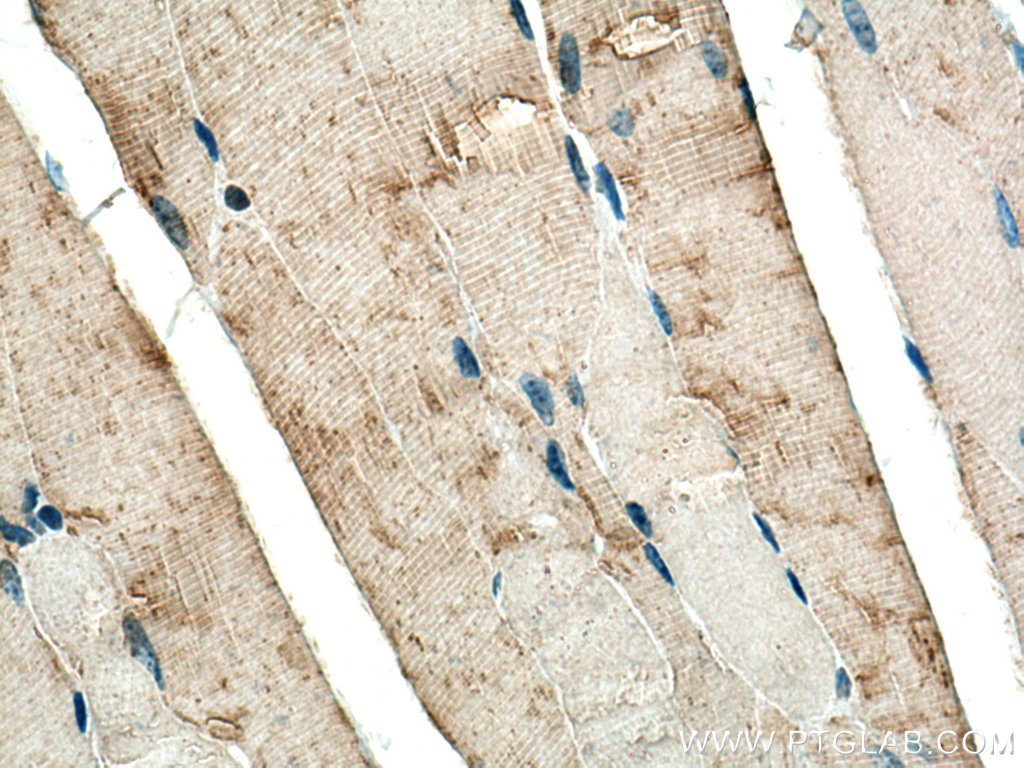 IHC staining of mouse skeletal muscle using 14647-1-AP (same clone as 14647-1-PBS)