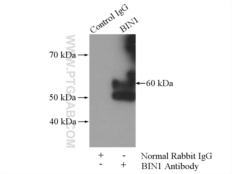 IP experiment of mouse brain using 14647-1-AP