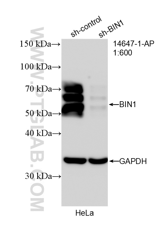 WB analysis of HeLa using 14647-1-AP