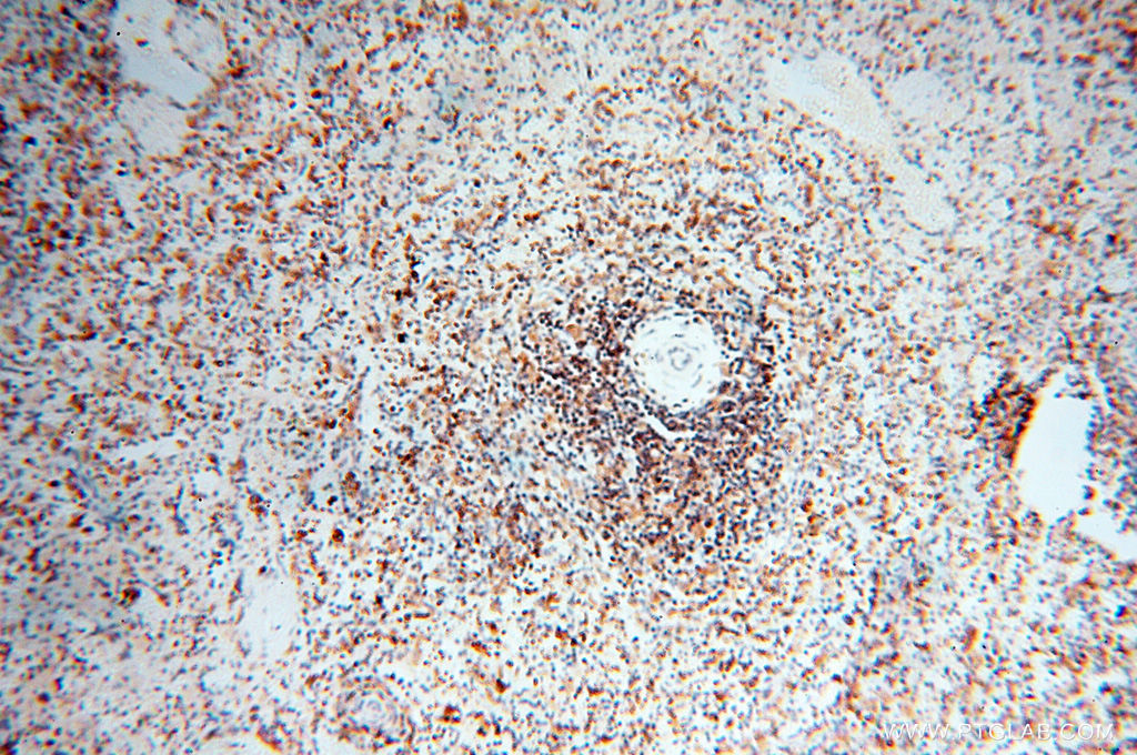 IHC staining of human spleen using 14245-1-AP