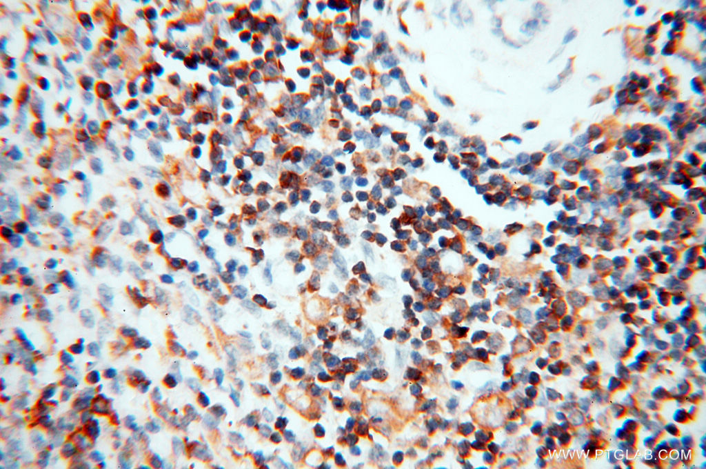 IHC staining of human spleen using 14245-1-AP