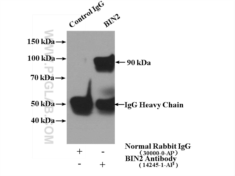 IP experiment of Jurkat using 14245-1-AP