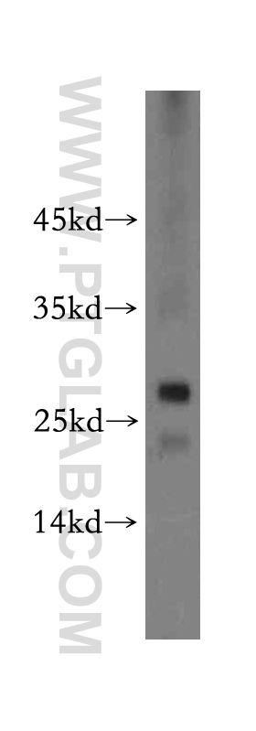 WB analysis of Jurkat using 20186-1-AP