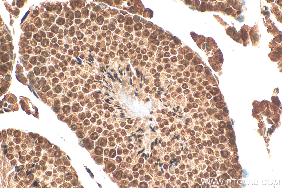 IHC staining of mouse testis using 10022-1-AP