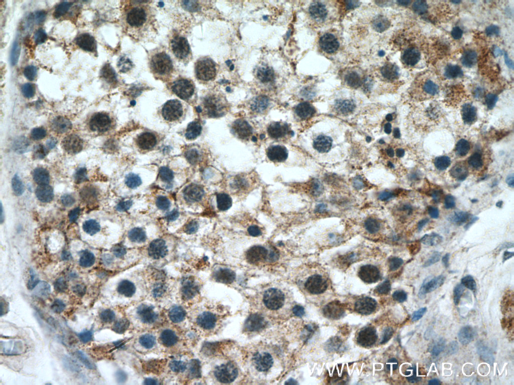 IHC staining of human testis using 10022-1-AP