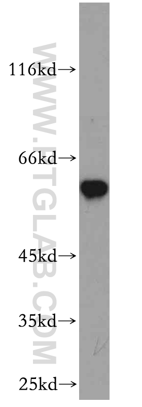 WB analysis of mouse skeletal muscle using 10022-1-AP