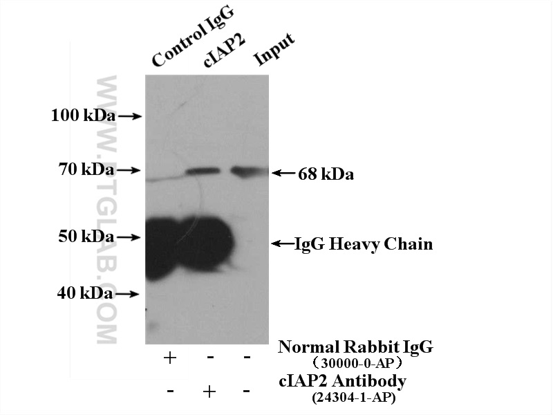 IP experiment of Daudi using 24304-1-AP