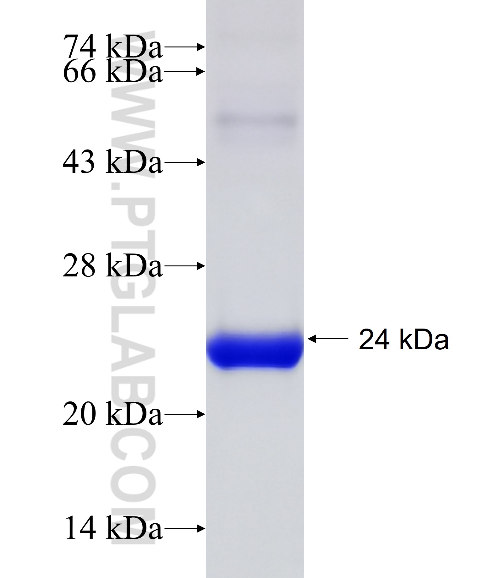 BIRC6 fusion protein Ag30742 SDS-PAGE BIRC6 fusion protein Ag30742 SDS-PAGE