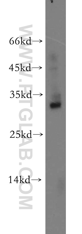 WB analysis of mouse brain using 20144-1-AP