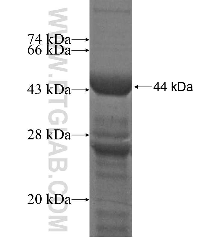 BLIMP1 fusion protein Ag16764 SDS-PAGE BLIMP1 fusion protein Ag16764 SDS-PAGE