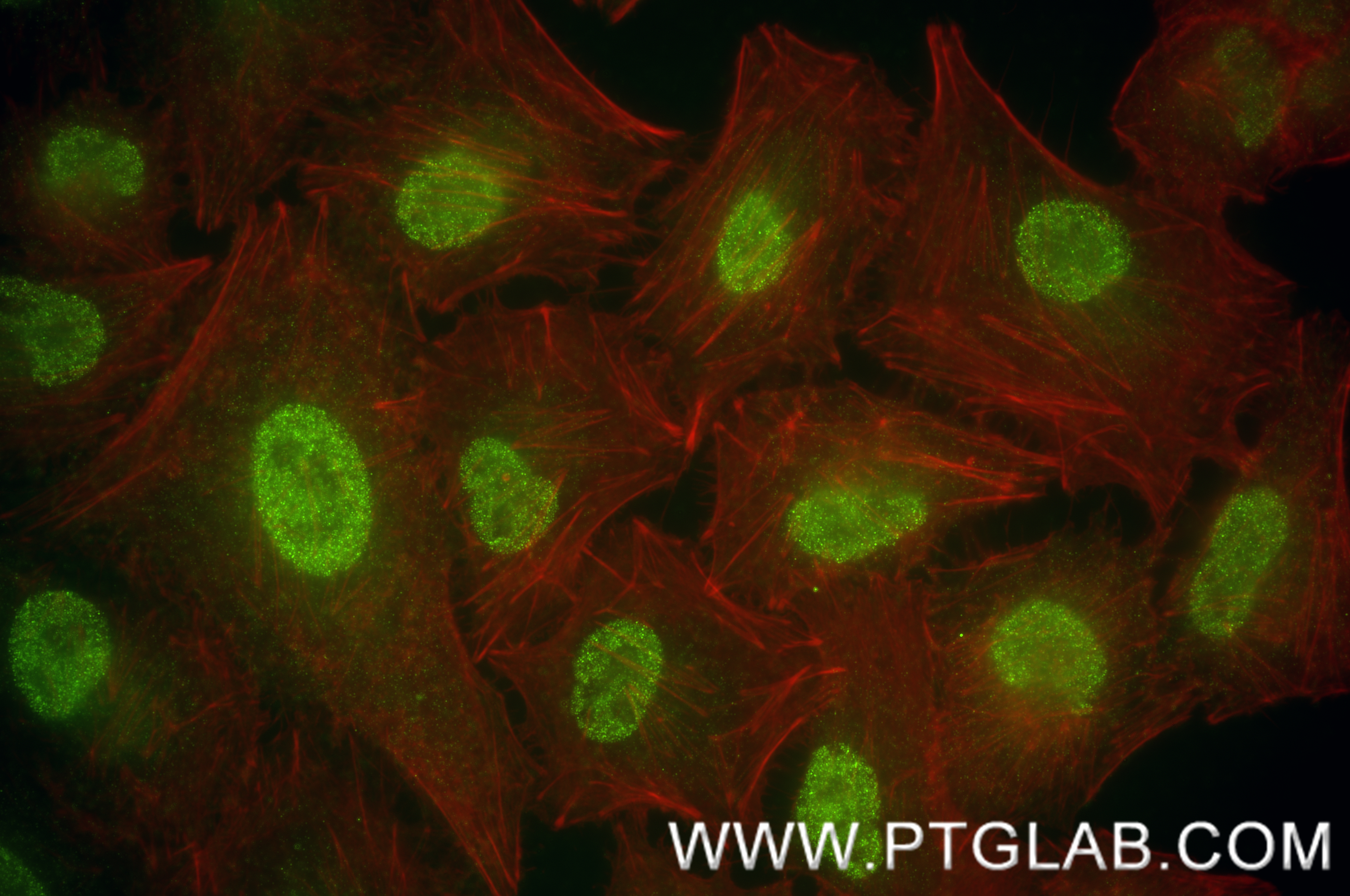 IF Staining of A549 using 84625-3-RR (same clone as 84625-3-PBS)