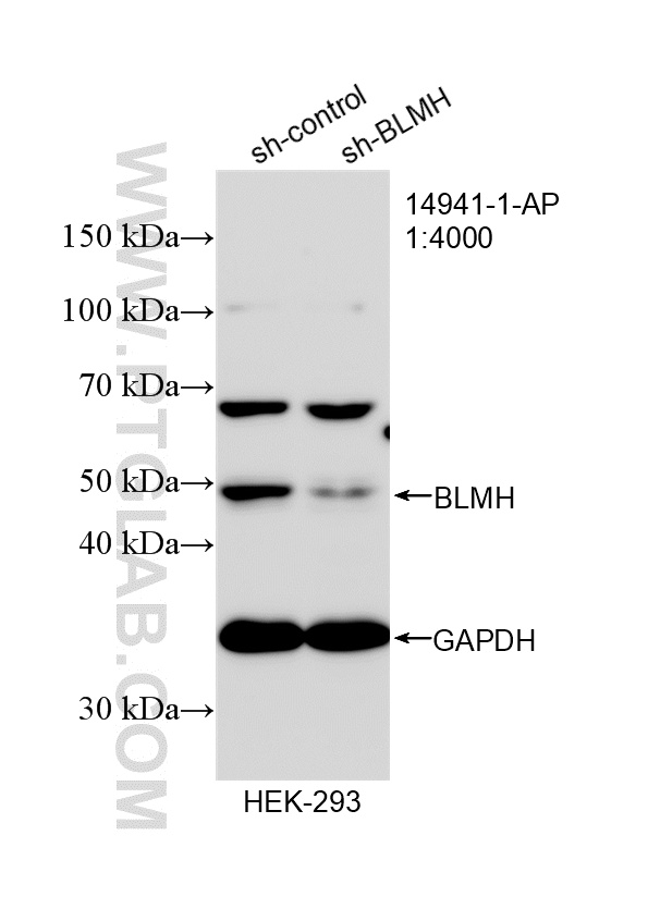 WB analysis of HEK-293 using 14941-1-AP WB analysis of HEK-293 using 14941-1-AP