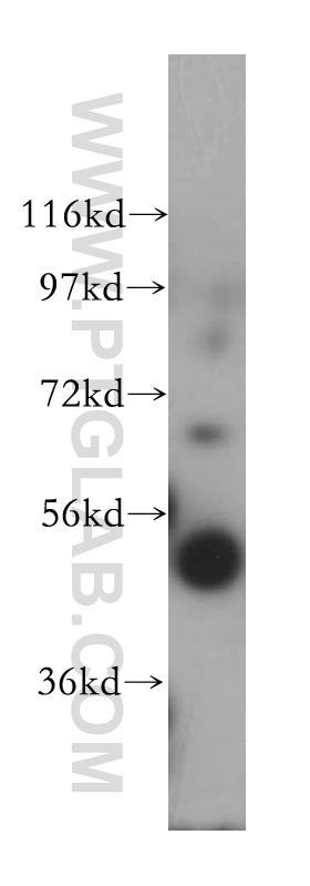 WB analysis of human colon using 14941-1-AP