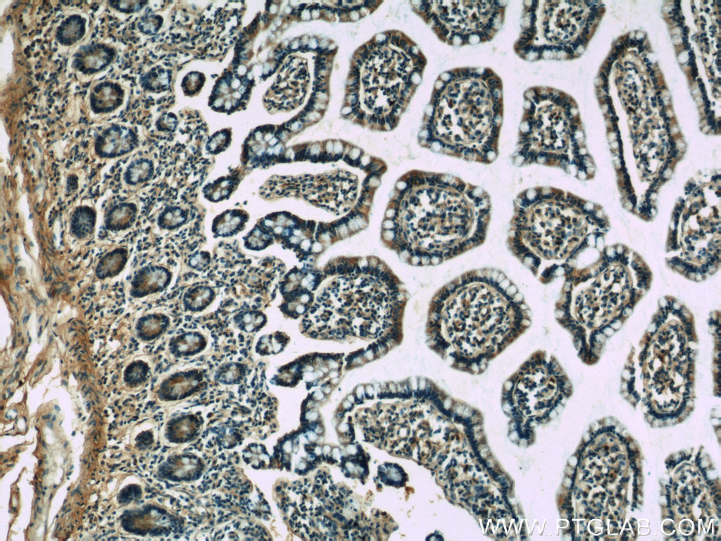 IHC staining of human small intestine using 19687-1-AP