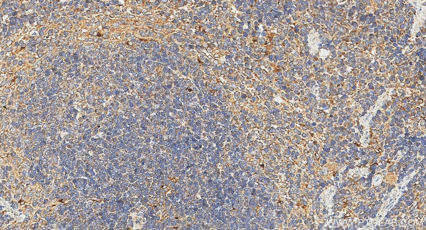IHC staining of mouse spleen using 88427-1-RR