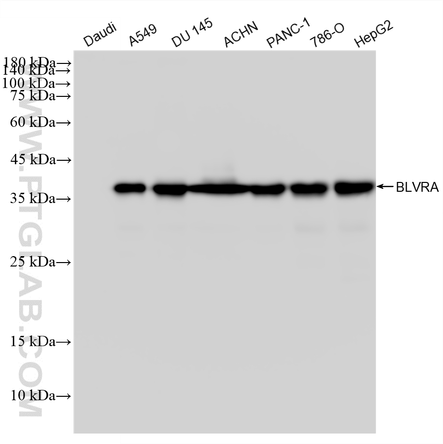 WB analysis using 88427-1-RR