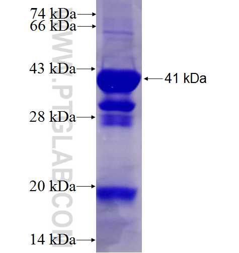 BLZF1 fusion protein Ag9879 SDS-PAGE BLZF1 fusion protein Ag9879 SDS-PAGE