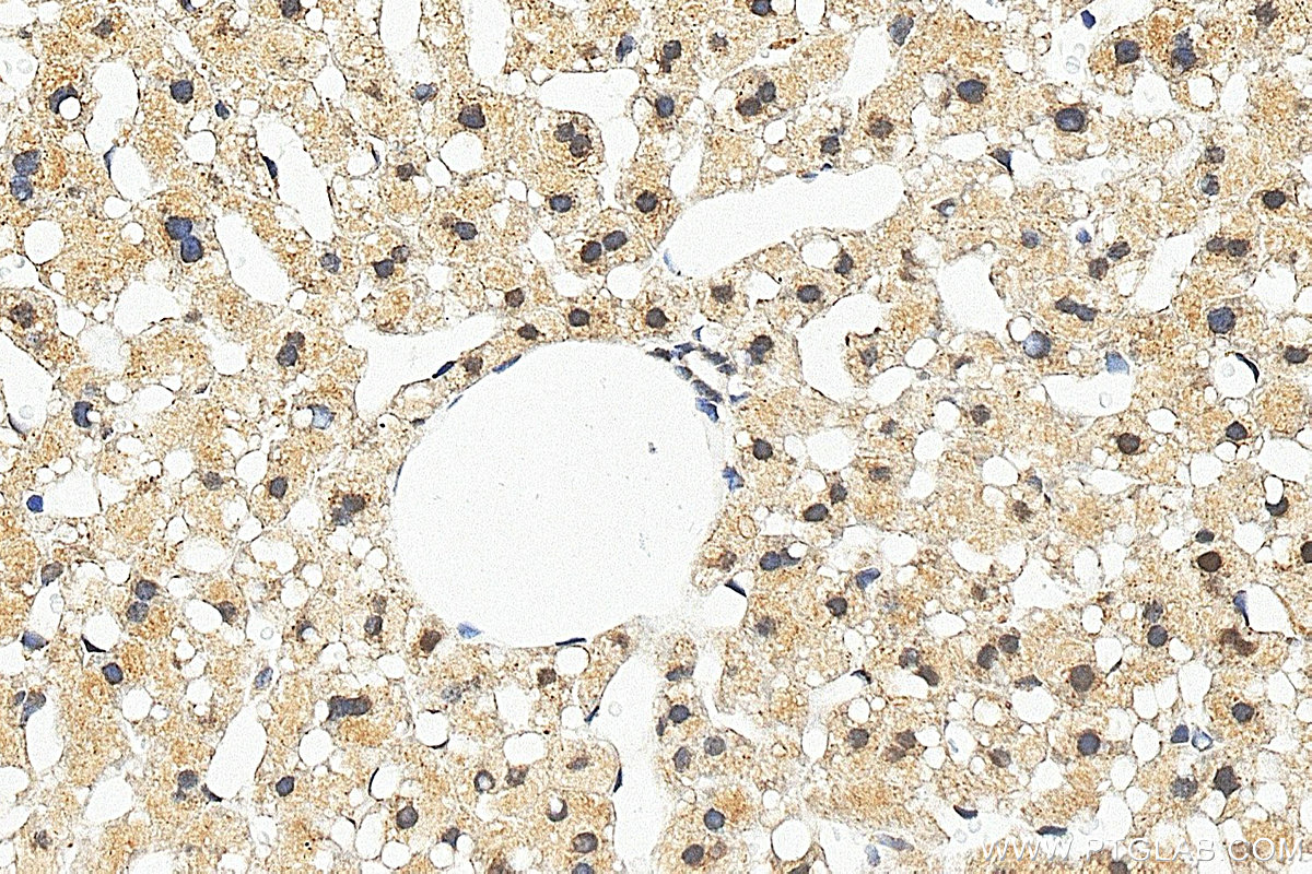 IHC staining of mouse liver using RMX00100 IHC staining of mouse liver using RMX00100