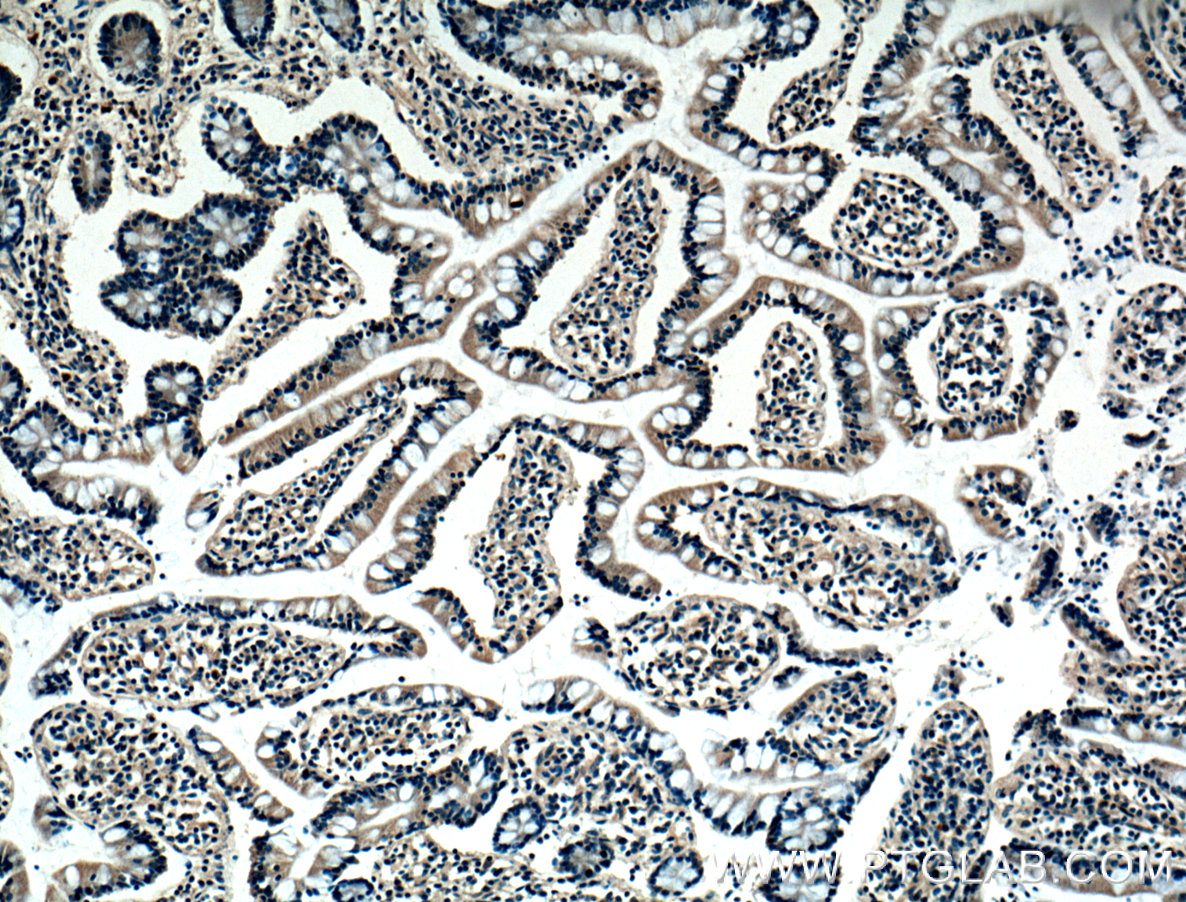 IHC staining of human small intestine using 66383-1-Ig