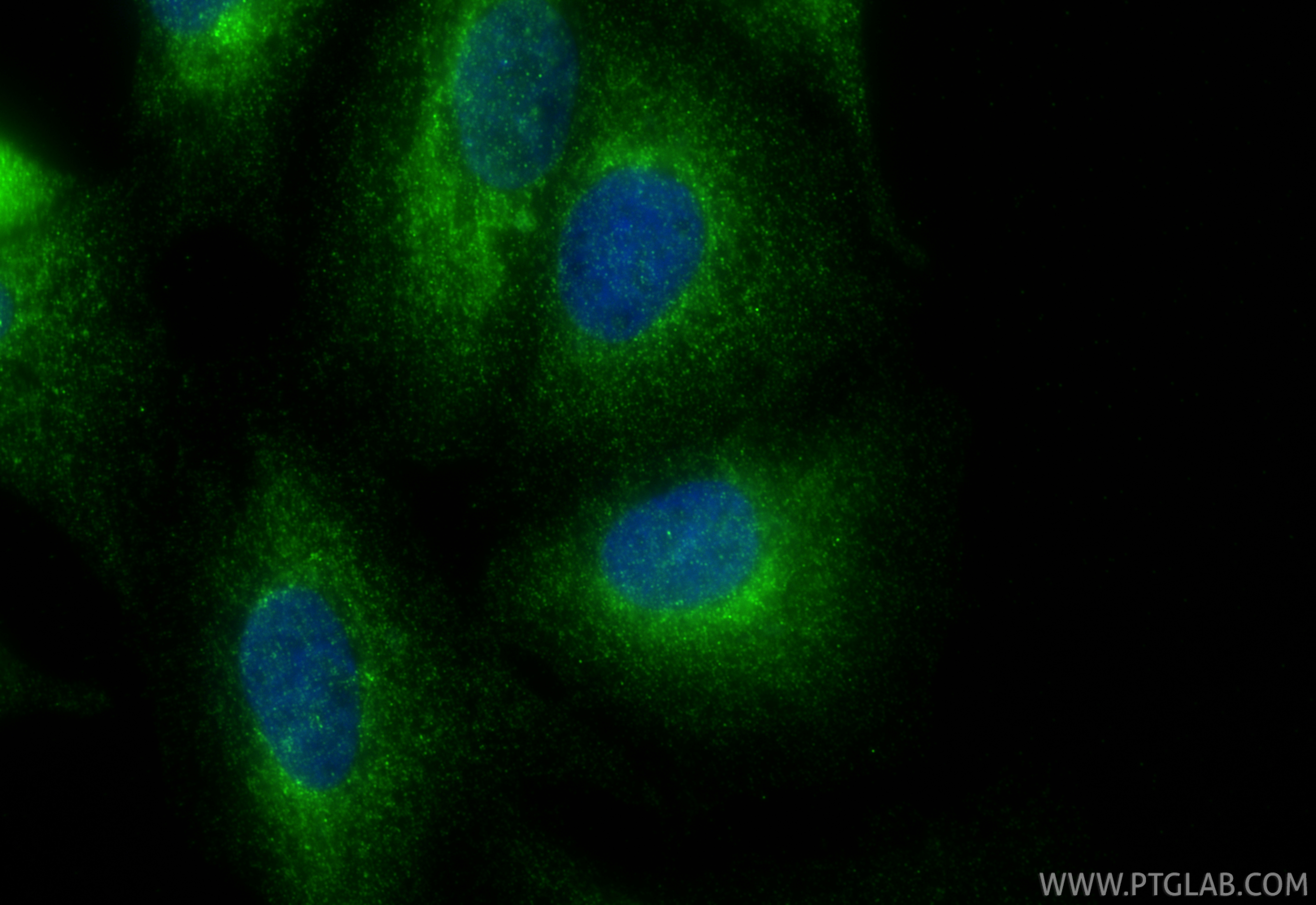 IF Staining of A549 using 12492-1-AP