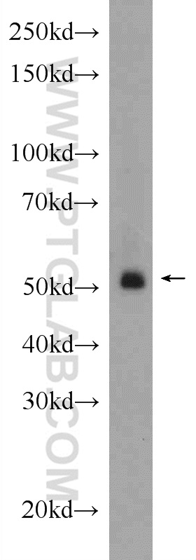 BMP4 Polyclonal antibody