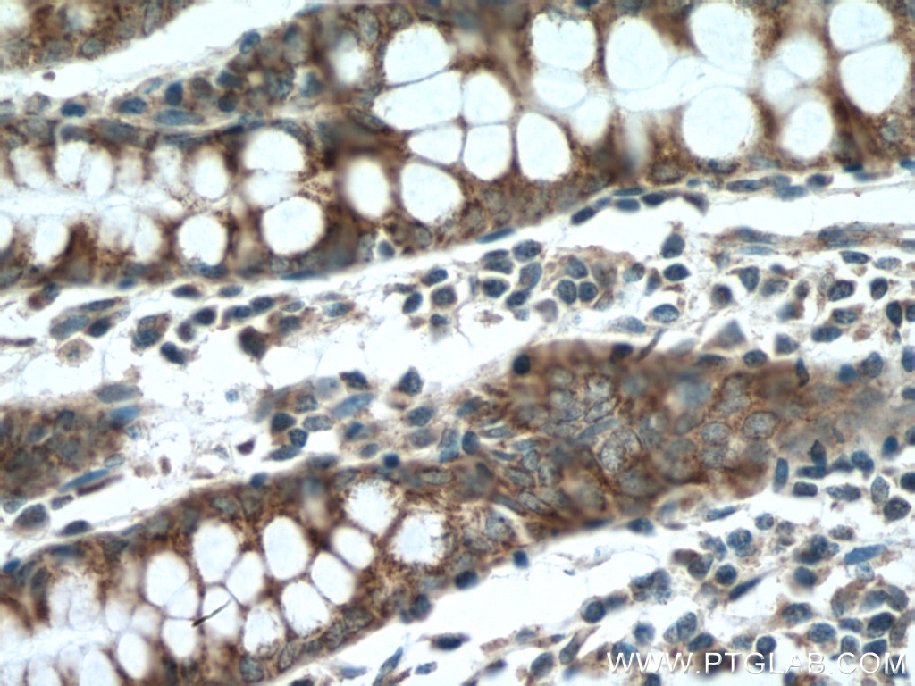 IHC staining of human colon using 13253-1-AP