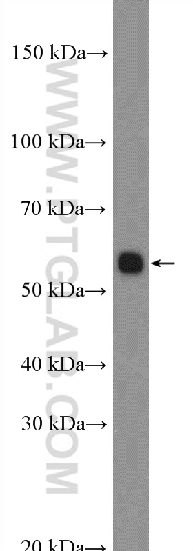 WB analysis of mouse lung using 13253-1-AP