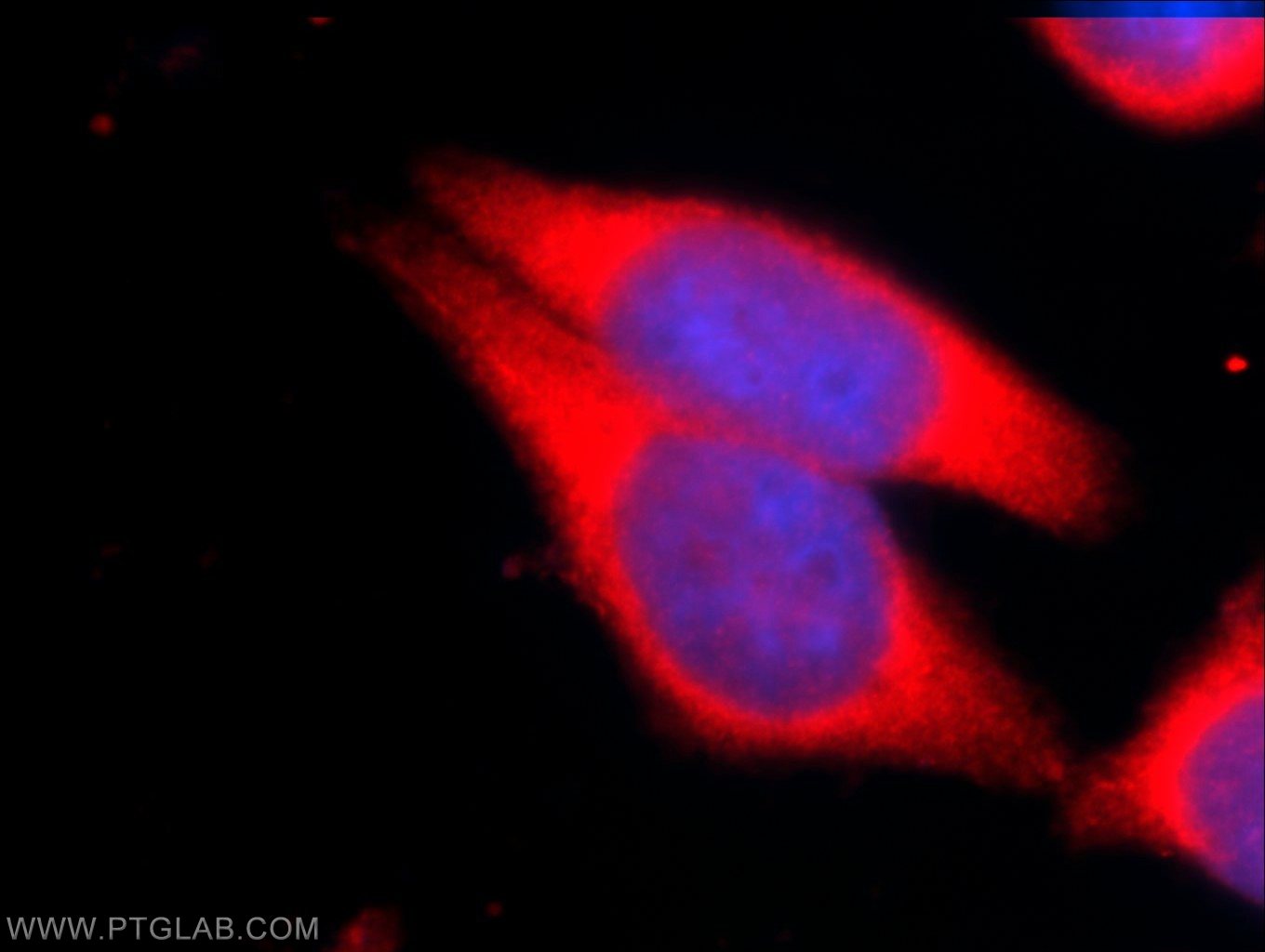 BMPR1A Polyclonal antibody