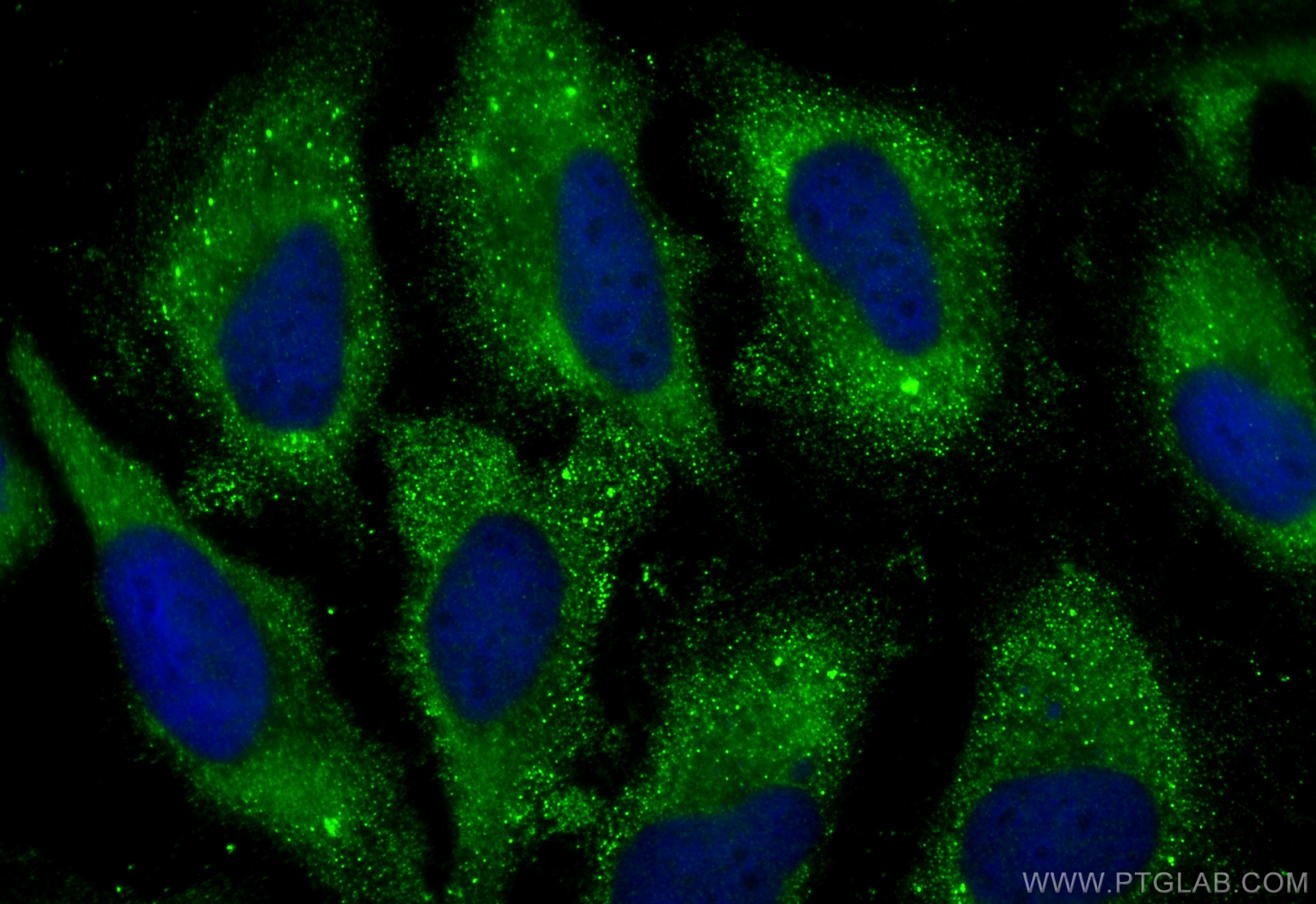 IF Staining of HeLa using 12702-1-AP