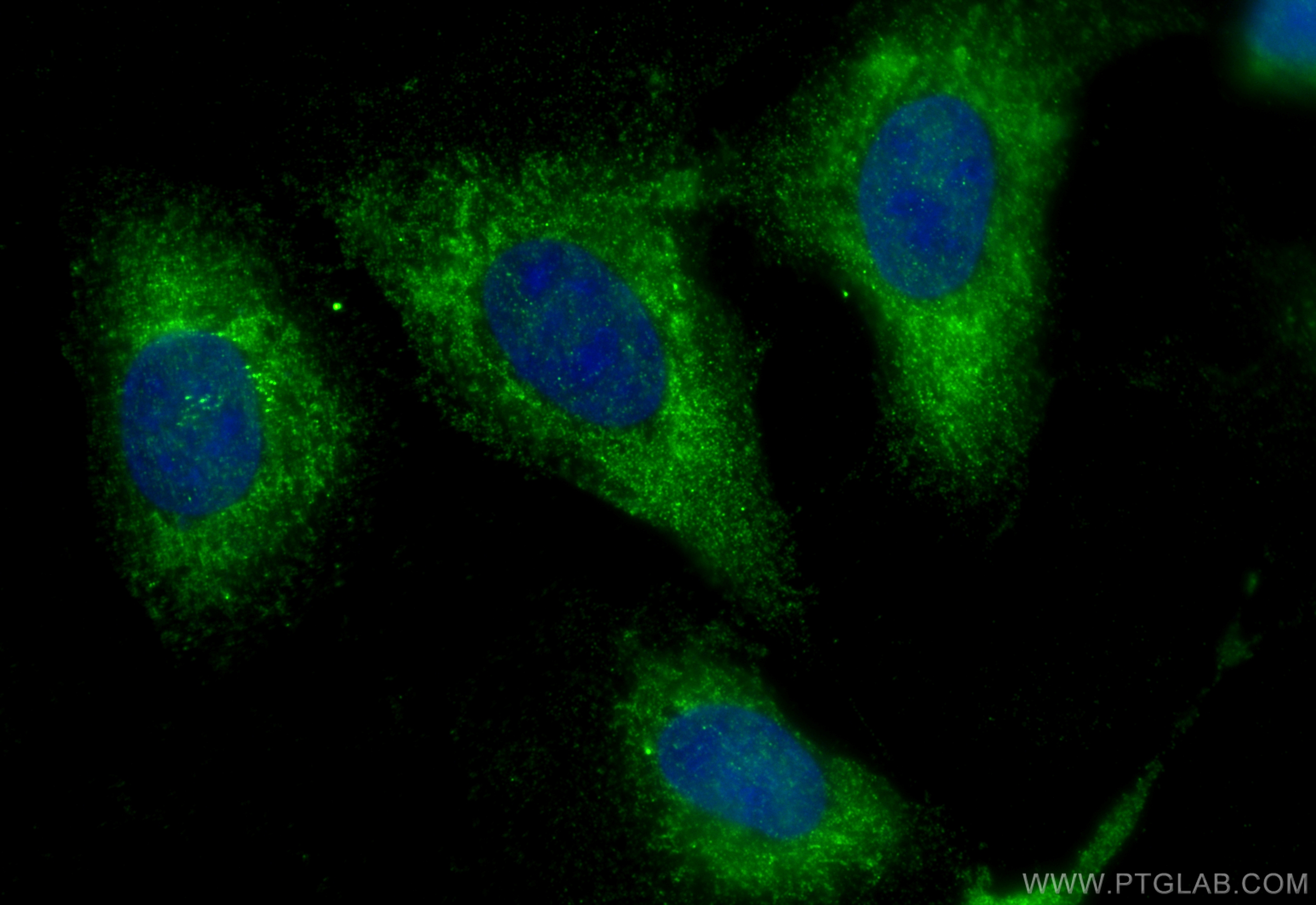 IF Staining of U2OS using 12702-1-AP
