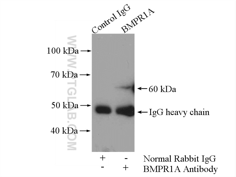 IP experiment of HEK-293 using 12702-1-AP